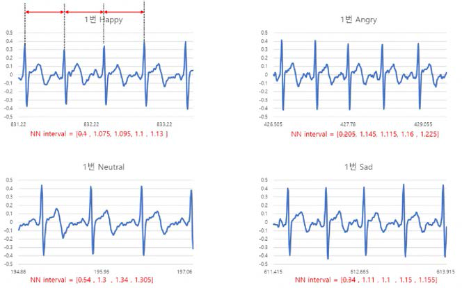 ECG 신호로부터 얻은 NN 간격 분석(감정별 5 초 길이)