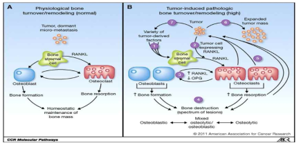 건강한 상태에서는 조골세포와 파골세포간의 유기적 관계를 통해 뼈의 항상성이 유지되지만, 골전이는 골생태계의 불균형을 초래하여 골파괴를 일으켜 암세포의 성장을 돕게 됨