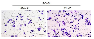 PC-3 세포주에 IL-7(10 ng/ml)을 24 시간 처리하면 PBS를 처리한 세포주 대비 침투능 증가