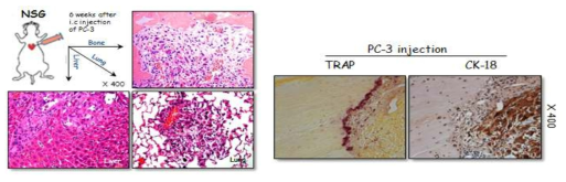NSG 생쥐에 유전자 조작된 암세포주를 심장주입 후 심장, 폐, 간, 뼈에서 암세포주를 확인할 수 있음(왼쪽). 암세포(CK-18 양성: 갈색)가 있는 뼈조직에서는 파골세포(TRAP 양성: 붉은색)가 다량 확인됨(오른쪽)