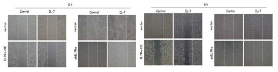 migration assay 결과 IL-7 처리 6시간 후 PC-3의 이동능이 증가하였음 (대표사진)