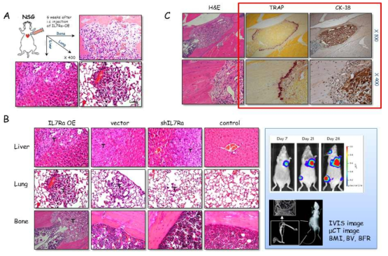 (A) NSG 생쥐에 전립선암세포주를 심장주사한 후 6주 뒤 뼈, 간, 폐로 전이된 암세포 사진. (B) 뼈전이 부위에 암세포와 파골세포를 조직면역화학염색과 특수염색으로 확인한 결과, 암세포 주위에 파골세포가 형성된 것을 확인할 수 있었음. (C) 암세포에 IL-7Ra를 과발현하거나 억제했을 때 전이된 암세포의 크기변화가 관찰되었음