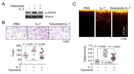 JAK inhibitor인 tofacitinib을 이용한 전이 저해