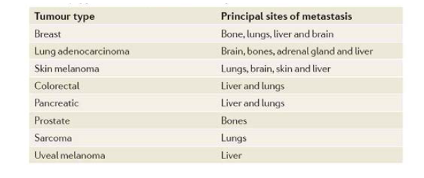 암종에 따른 전이 위치