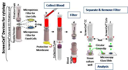 CTCs-biomarker free ScreenCell system을 이용한 혈중 암세포 분리