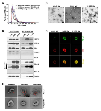 암세포에서 분비되는 microvesicle 내에 PD-L1 발현 확인