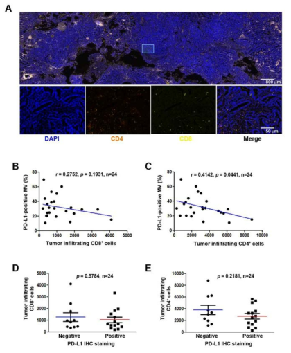 PD-L1 발현과 tumor infiltrating T cell의 상관관계