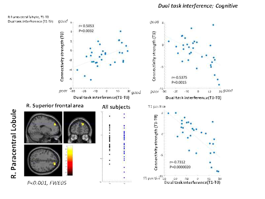 우반구 paracentral lobule이 seed 영역일 때 우반구 superior frontal area와 연결성이 증가할수록 Dual task interference가 악화