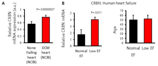 NCBI 임상데이터 분석(A) 와 실제심부전 환자 심장샘플 분석(B)을 통한 심장질환환자 CRBN 발현 증가 확인