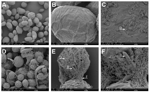 Mid-exponential에서 Ettlia sp.의 axenic 세포 표면 구조(A-C)와 xenic 세포 표면 구조(D-F)의 SEM 이미지들