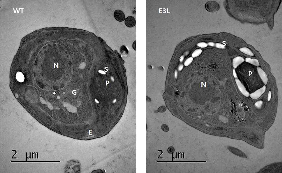 투과 전자현미경 (Transmission Electron Microscopy) 를 이용한 야생종 (WT) 과 E3L의 내부구조 관찰