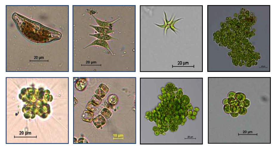 고체배지에서 분리한 미세조류 현미경 사진(x200, x400)