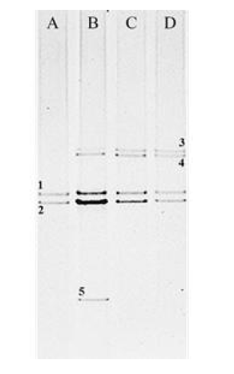 연소배가스를 이용한 Chlorella sp. KR-1의 배양시 배양액내 증폭된 박테리아 16S rRNA 유전자조각의 DGGE 패턴, A; 자가영양 조건, B; batch 복합영양, C; fed-batch 복합영양, D; fed-batch 복합영양 및 dark cycle동안 air 공급 (각 밴드는 번호 순서대로 추출, 재증폭 및 시퀀싱 진행)
