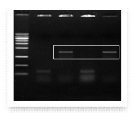 NRS catalytic domain의 colony PCR 결과