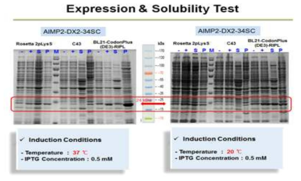 AIMP2-DX2-34S 단백질의 발현 및 수용성 실험