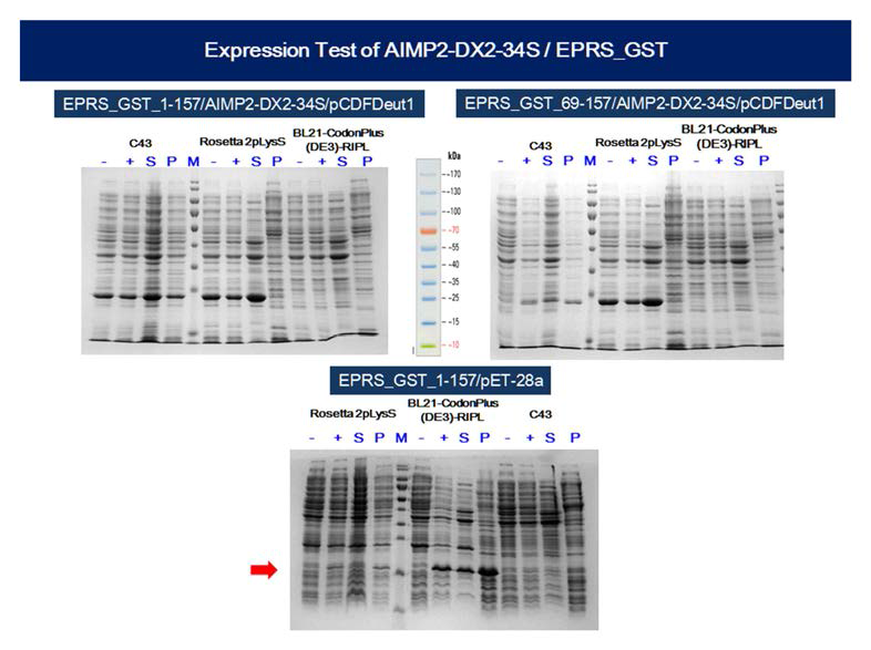 AIMP2-DX2-34S/EPRS_GST 단백질의 발현 및 수용성 실험