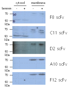KRS-pT52에 대한 추가 클론들의 확보. F8, C11의 경우 세포질에서 50 kDa 위치의 밴드가 확인되나 어떤 단백질인지 분석하지 못함