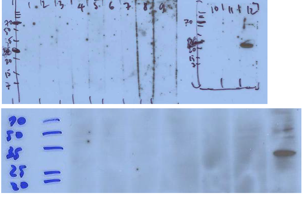면역블로팅을 이용한 AIMP2-DX2 항체의 확인. ELISA 스크리닝으로부터 찾은 항체들을 대상으로 H460 lysate 내의 AIMP2-DX2 단백질을 특이적으로 검출할 수 있는 항체를 확인하였음. (위) 클론 H5 (12번 레인), (아래) 클론 E11 (맨 오른쪽)