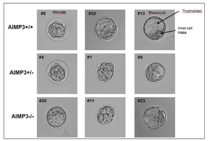 E3.5시점에서 Embryo를 취해 형태를 현미경으로 관찰하고 Genotype를 PCR방법으로 확인함. 결과 AIMP3+/+, AIMP3+/-, AIMP3-/-모두 존재하였고, 형태는 모두 정상 이였으며 차이가 없었음