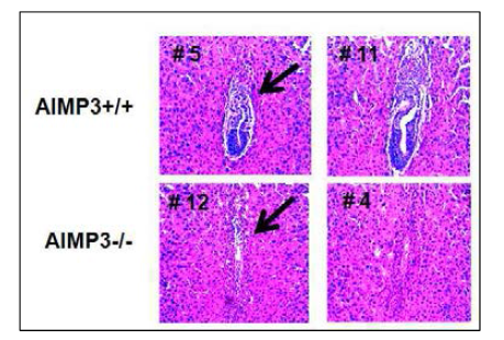 AIMP3+/- 마우스를 Mating 시켜, E6.5시점에서 Embryo를 취해 H&E 염색하였음. 결과 AIMP3-/-로 추측되는 흔적만 남은 Embryo들이 존재함. AIMp3는 착상 전후 배아발달 과정에 필수적임을 알 수 있음