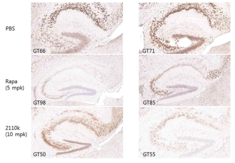 TSC2GFAP CKO 마우스에서 2110K 투여에 의한 뇌조직에서의 mTORC1 저해효과