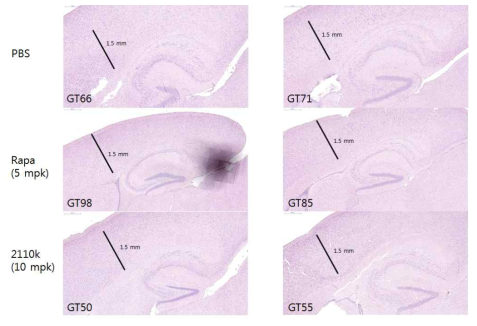 TSC2GFAP CKO 마우스에서 2110K 투여에 의한 cortex thickness 감소효과