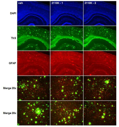 치매 마우스 모델에서 2110K 투여에 의한 amyloid-beta palque 감소 효과