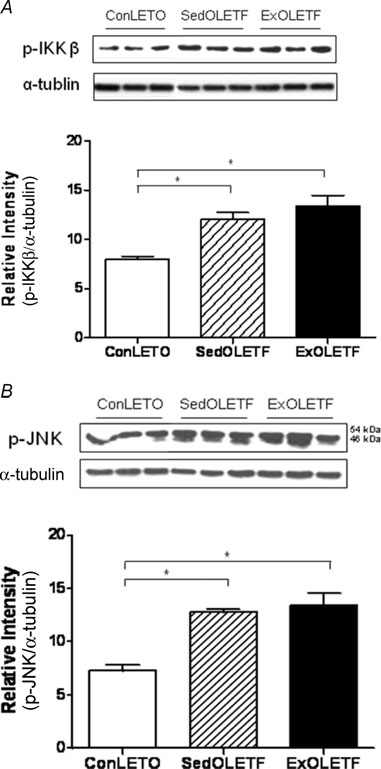 Effects of exercise training and type 2 diabetes on phosphorylation of IκB kinase β (IKKβ) and c-Jun N-terminal kinase (JNK). The cytoplasmic fraction was subjected to Western blot analysis to measure the levels of p-IKKβ (A) and p-JNK (B) using specific antibodies. The data were quantified using image densitometric analysis