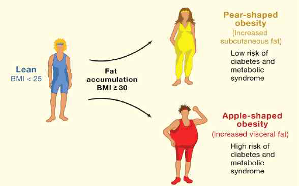 복부형 비만과 복부지방의 증가는 다른 대사성 질환의 유병률을 증가시킴 (Cell 131;2242, 2007)