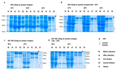 Laminin receptor와 KRS-S52ph 또는 GST KRS-S52ph의 pull down assay 결과를 SDS-PAGE로 확인