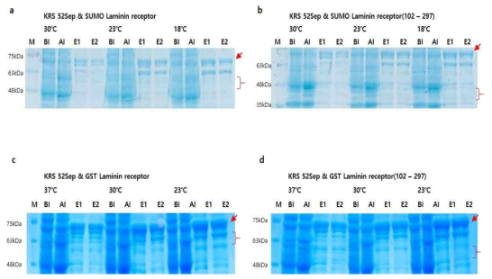 KRS-S52ph과 GST Laminin receptor 또는 SUMO Laminin receptor의 pull down assay 결과를 SDS-PAGE로 확인