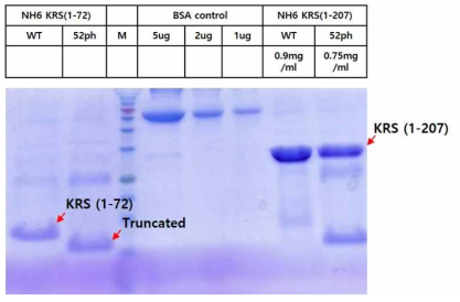 KRS wild type과 인산화 KRS 단백질의 발현 및 정제