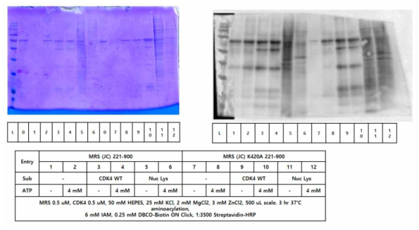 MetRS wt과 MetRS K420A의 western blot 결과