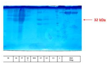 Recombinant Human SIRT3 (102-399)의 발현