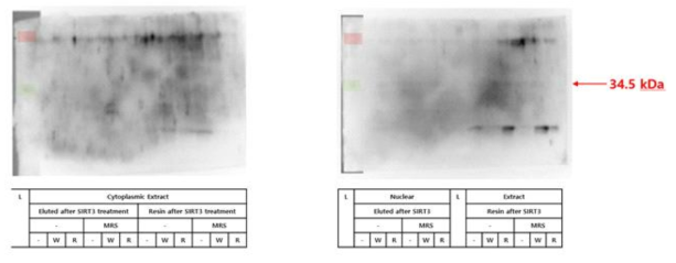 MRS에 의한 CDK4의 in vivo aminoacylation 여부 확인