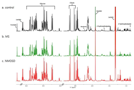 각 group의 대표 NMR spectrum 비교. 표시된 대사체들에서 통계적으로 유의한 변화를 규명함