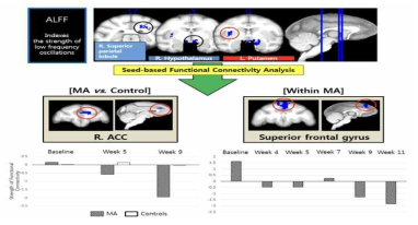 메스암페타민 만성 마약 노출 모델의 뇌연결성 감소