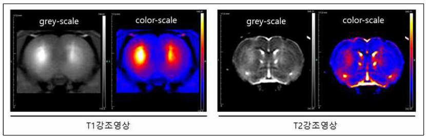 Stereotaxic atlas의 위치정보를 기반으로 MRI 영상을 통한 실제 표적위치 확인