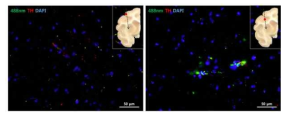 Lenti-GFP 발현과 Dopaminergic neurons (TH, Trosine hydroxylase)의 형광 염색을 통한 발현 양상 확인