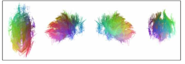 Macaca fascicularis의 DTI tractography 구현