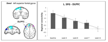 superior frontal gyrus와 dorsal lateral prefrontal cortex(DLPFC) 간의 뇌기능 연결성 감소