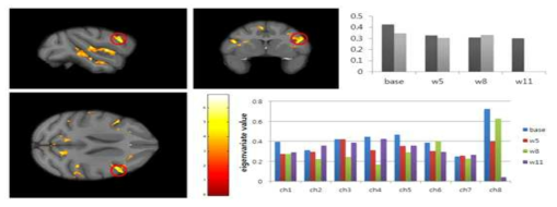 만성군 코카인 투여 이후 회백질 부피 감소: dorsolateral prefrontal cortex