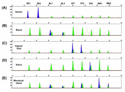 Representative electropherograms of body fluid identification using multiplex methylation SNaPshot; SE1, SE2, BL1, BL3, VF1, VF2, SA1, MB1 and MB2 represent cg17610929, cg26763284-138d, cg06379435, cg08792630, cg09765089-231d, cg26079753-7d, cg09652652-2d, cg18069290 and cg09696411, respectively