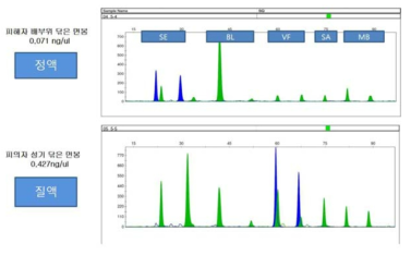 Body fluid identification of casework samples from a rape case