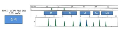 Body fluid identification of casework samples from a sexual attack