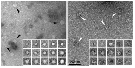 Negative staining of GRS associated exosomes, showing general appearance (left) and immuno-EM negative stained exosomes (right)