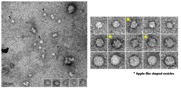 General appearances of KRS associated exosome (left) and its apple-like shaped exosome (right, yellow asterisks)