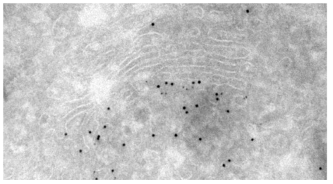 Gold label immuno-EM on cryo-sections of a test cell