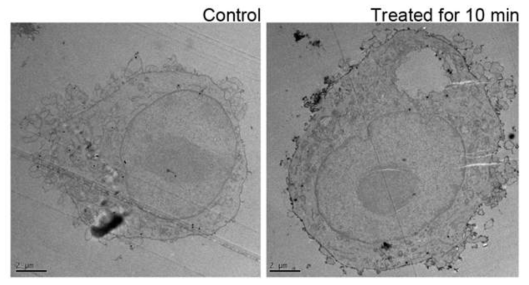 Morphological changes of cell after exogeneous exosome treatment