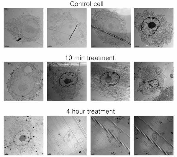 Time scaled morphological views of the cell treated with exogenous exosomes